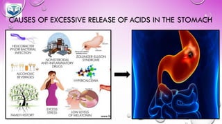 CAUSES OF EXCESSIVE RELEASE OF ACIDS IN THE STOMACH
 