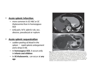 Gastrointestinal and Hepatic manifestations of Systemic Diseases -II.pptx
