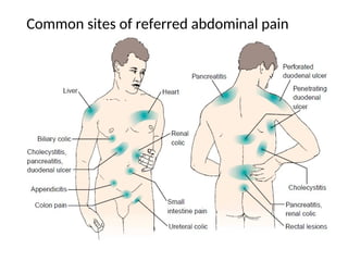Common sites of referred abdominal pain
 