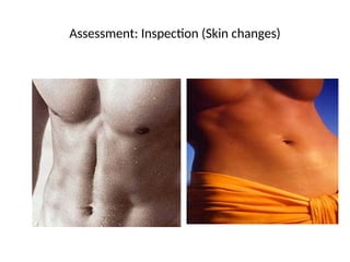Assessment: Inspection (Skin changes)
 