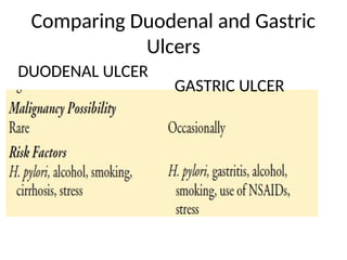 Comparing Duodenal and Gastric
Ulcers
DUODENAL ULCER
GASTRIC ULCER
 