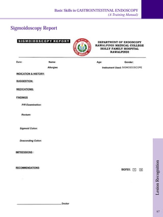 Basic Skills in GASTROINTESTINAL ENDOSCOPY 
Sigmoidoscopy Report 
(A Training Manual) 
Lesion Recognition 
97 
 