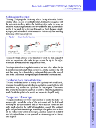 Basic Skills in GASTROINTESTINAL ENDOSCOPY 
(A Training Manual) 
Colonoscope Steering: 
Twisting (Torquing) the shaft only affects the tip when the shaft is 
straight when a loop is present in the shaft, twisting forces applied will 
be lost within the loop. When the shaft is straight, twist becomes an 
excellent way to torque or corkscrew around bends. This is particularly 
useful if the angle to be traversed is acute or fixed, because simply 
trying to push around will encounter severe resistance (often resulting 
in looping rather than progress). 
Colonoscopy / Sigmoidoscopy Technique Fig 10.2 Single handed Steering 
Twist only affects the 
tip if the shaft is straight. 
Up 
Left 
Down 
Right 
with a clockwise shaft twist: (a) an up-angled tip moves to the right (b) and a down-angled tip 
moves to the left. 
Torque steering is affected by the direction in which the tip is angulated 
with up angulations, clockwise torque moves the tip to the right, 
whereas it moves to the left if angulation is down. 
Steering with the lateral angulation control has least effect when the tip 
is already maximally angled (up and down). A fully angulated tip will 
not slide along the colon similarly an impacted tip cannot be steered 
and in this situation on attempted angulation the shaft moves instead. 
Two handed one person technique 
The two handed technique is mainly used by those with small hands, 
who may be unable to reach the lateral angulation control with the left 
thumb and may need to use right hand for this purpose. This means 
that briefly the instrument shaft will be left free while the angulation is 
made. So it is likely that endscopist is not torque steering efficiently. 
Two person colonoscopy 
Two person colonoscopy relies on an assistant to handle the shaft. The 
endoscopist control the body of the instrument with the left hand 
working the up/down control and air/water/suction valves and the 
right hand adjusting the right/left angulation control. The assistant 
pulls and pushes the endoscope according to the spoken instructions 
of the endoscopist. Unless endoscopist/assistant team work is skilled 
and interactive the two person approach to colonoscopy can be clumsy 
and illogical. 
65 
 