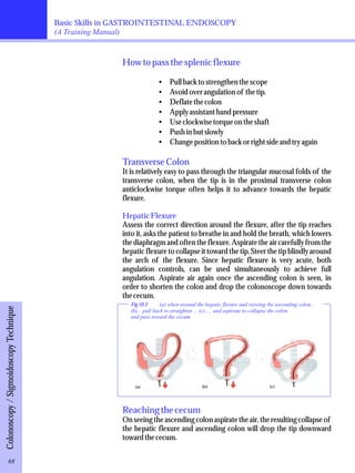 Basic Skills in GASTROINTESTINAL ENDOSCOPY 
(A Training Manual) 
How to pass the splenic flexure 
·Pull back to strengthen the scope 
·Avoid over angulation of the tip. 
·Deflate the colon 
·Apply assistant hand pressure 
·Use clockwise torque on the shaft 
·Push in but slowly 
·Change position to back or right side and try again 
Transverse Colon 
It is relatively easy to pass through the triangular mucosal folds of the 
transverse colon, when the tip is in the proximal transverse colon 
anticlockwise torque often helps it to advance towards the hepatic 
flexure. 
Hepatic Flexure 
Assess the correct direction around the flexure, after the tip reaches 
into it, asks the patient to breathe in and hold the breath, which lowers 
the diaphragm and often the flexure. Aspirate the air carefully from the 
hepatic flexure to collapse it toward the tip. Steer the tip blindly around 
the arch of the flexure. Since hepatic flexure is very acute, both 
angulation controls, can be used simultaneously to achieve full 
angulation. Aspirate air again once the ascending colon is seen, in 
order to shorten the colon and drop the colonoscope down towards 
the cecum. 
(a) (b) (c) 
Reaching the cecum 
On seeing the ascending colon aspirate the air, the resulting collapse of 
the hepatic flexure and ascending colon will drop the tip downward 
toward the cecum. 
Colonoscopy / Sigmoidoscopy Technique 
Fig 10.3 (a) when around the hepatic flexure and viewing the ascending colon.. 
(b)... pull back to straighten ... (c) .... and aspirate to collapse the colon 
and pass toward the cecum. 
68 
 