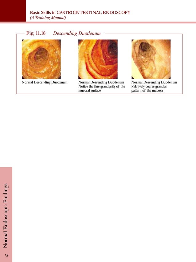 Gastrointestinal endoscopy training manual PDF