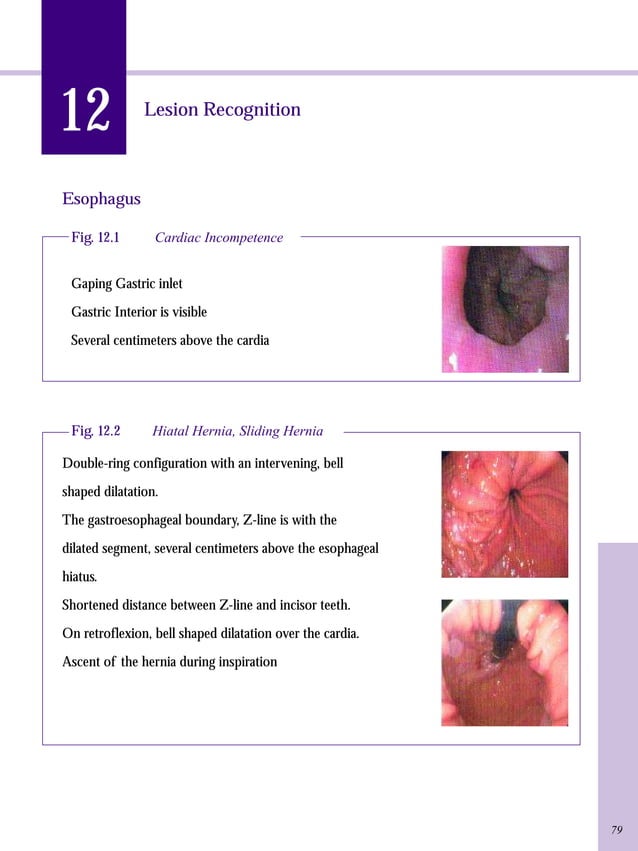 Gastrointestinal endoscopy training manual PDF
