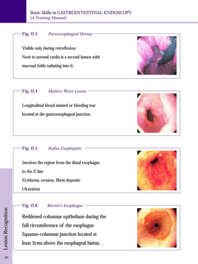 Gastrointestinal endoscopy training manual PDF
