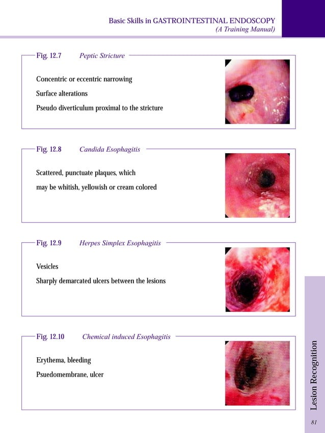 Gastrointestinal endoscopy training manual PDF