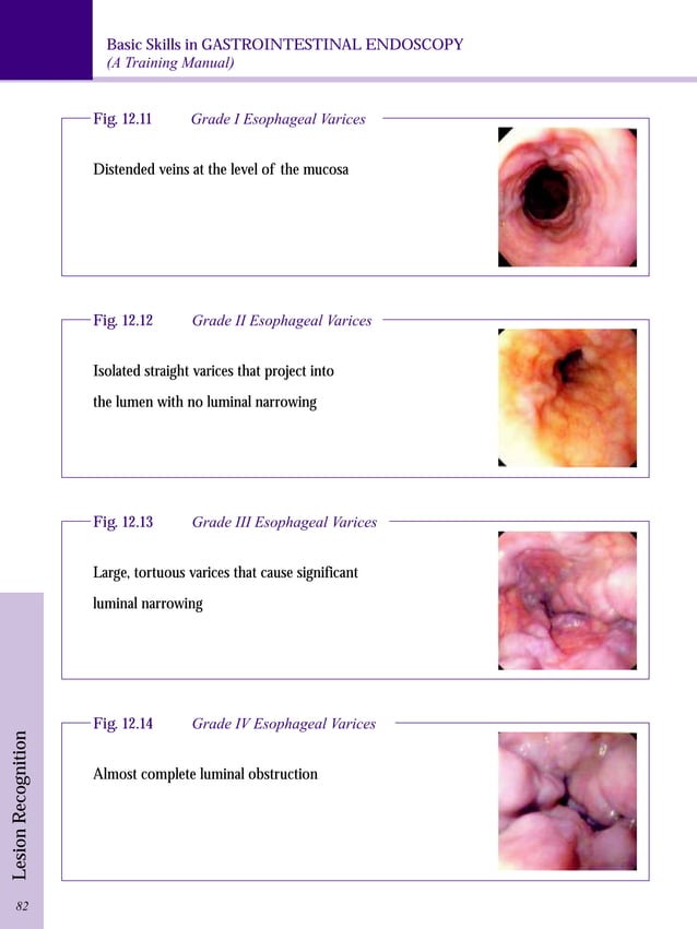 Gastrointestinal endoscopy training manual PDF