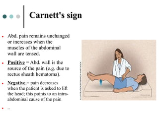 Carnett Sign Negative Gastrointestinal (GI) examination. Seminar ppt. | PPT