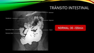 Intestino Normal GASTROINTESTINAL INTESTINO DELGADO.pptxx | PPTX
