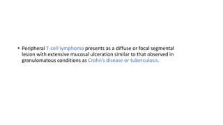 • Peripheral T-cell lymphoma presents as a diffuse or focal segmental
lesion with extensive mucosal ulceration similar to that observed in
granulomatous conditions as Crohn’s disease or tuberculosis.
 