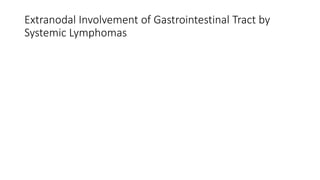 Extranodal Involvement of Gastrointestinal Tract by
Systemic Lymphomas
 