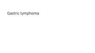Gastric lymphoma
 