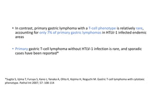 • In contrast, primary gastric lymphoma with a T-cell phenotype is relatively rare,
accounting for only 7% of primary gastric lymphomas in HTLV-1 infected endemic
areas
• Primary gastric T-cell lymphoma without HTLV-1 infection is rare, and sporadic
cases have been reported*
*Sugita S, Iijima T, Furuya S, Kano J, Yanaka A, Ohta K, Kojima H, Noguchi M. Gastric T-cell lymphoma with cytotoxic
phenotype. Pathol Int 2007; 57: 108-114
 