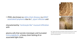 • IPSID, also known as alpha chain disease, is a MALT
associated lymphoma due to C. jejuni infection and
characterized by “centrocyte like” mucosal infiltration
with
plasma cells that secrete monotypic and truncated
immunoglobulin, a heavy chain lacking of an
associated light chain.
 