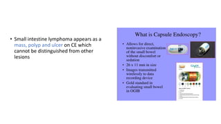 • Small intestine lymphoma appears as a
mass, polyp and ulcer on CE which
cannot be distinguished from other
lesions
 