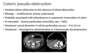gastrointestinal problems in cardiac surgical patients.pptx