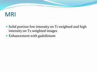 MRI
 Solid portion-low intensity on T1 weighted and high
  intensity on T2 weighted images
 Enhancement with gadolinium
 