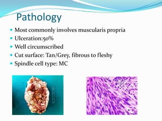 Pathology
 Most commonly involves muscularis propria
 Ulceration:50%
 Well circumscribed
 Cut surface: Tan/Grey, fibrous to fleshy
 Spindle cell type: MC
 