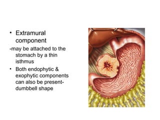 • Extramural
component
-may be attached to the
stomach by a thin
isthmus
• Both endophytic &
exophytic components
can also be present-
dumbbell shape
 