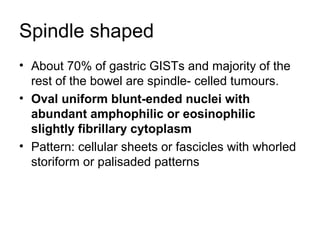 Spindle shaped
• About 70% of gastric GISTs and majority of the
rest of the bowel are spindle- celled tumours.
• Oval uniform blunt-ended nuclei with
abundant amphophilic or eosinophilic
slightly fibrillary cytoplasm
• Pattern: cellular sheets or fascicles with whorled
storiform or palisaded patterns
 