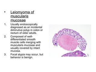 • Leiomyoma of
muscularis
mucosae
1. Usually endoscopically
diagnosed as an incidental
diminutive polyp in colon or
rectum of older adults.
2. Composed of well-
differentiated smooth
muscle cells merging with
muscularis mucosae and
usually covered by intact
mucosa.
3. Focal atypia may occur, but
behavior is benign.
 
