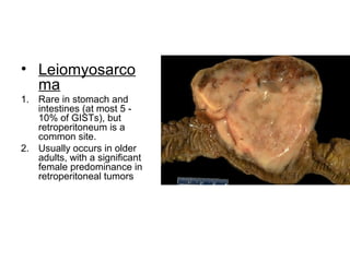 • Leiomyosarco
ma
1. Rare in stomach and
intestines (at most 5 -
10% of GISTs), but
retroperitoneum is a
common site.
2. Usually occurs in older
adults, with a significant
female predominance in
retroperitoneal tumors
 