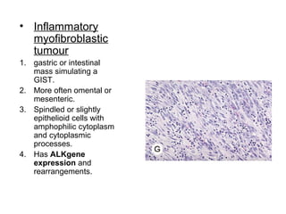 • Inflammatory
myofibroblastic
tumour
1. gastric or intestinal
mass simulating a
GIST.
2. More often omental or
mesenteric.
3. Spindled or slightly
epithelioid cells with
amphophilic cytoplasm
and cytoplasmic
processes.
4. Has ALKgene
expression and
rearrangements.
 