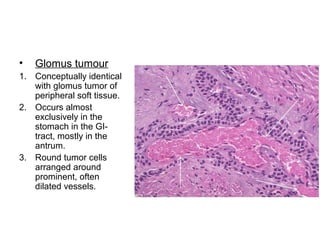 • Glomus tumour
1. Conceptually identical
with glomus tumor of
peripheral soft tissue.
2. Occurs almost
exclusively in the
stomach in the GI-
tract, mostly in the
antrum.
3. Round tumor cells
arranged around
prominent, often
dilated vessels.
 