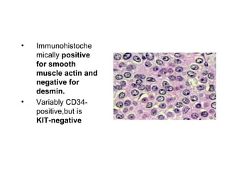 • Immunohistoche
mically positive
for smooth
muscle actin and
negative for
desmin.
• Variably CD34-
positive,but is
KIT-negative
 