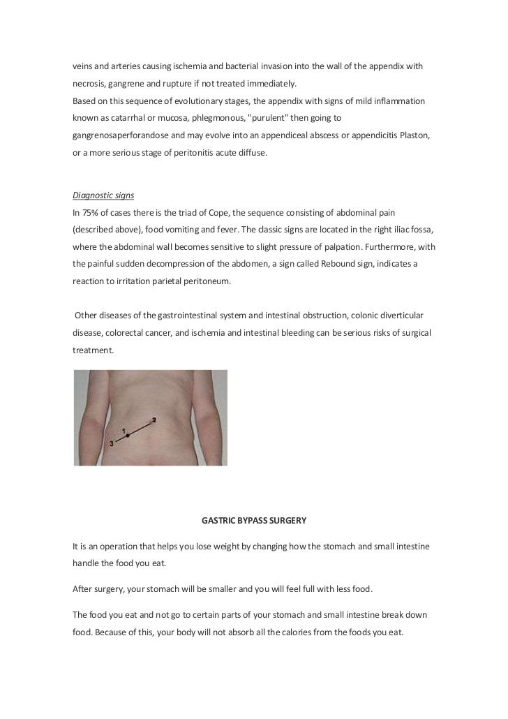 gastrointestinal-surgery-7-728.jpg?cb=1324973565