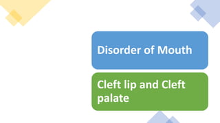 Disorder of Mouth
Cleft lip and Cleft
palate
 