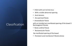 Classification
• Infant with out normal anus
• With a visible abnormal opening
• Anal stenosis
• Ano perineal fistula
• Anovestibular fistula
with an invisible but manifested opening of the bowel
Rectovagianal fistuala
• Recto urethral fistula
• Rectovesicular fistula
No manifested opening of the bowel
• Persistant anal membrane Rectal atresia
 