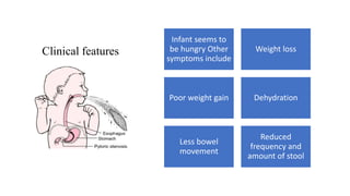 Clinical features
Infant seems to
be hungry Other
symptoms include
Weight loss
Poor weight gain Dehydration
Less bowel
movement
Reduced
frequency and
amount of stool
 