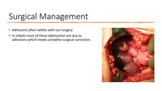 Surgical Management
• Adhesions often settles with out surgery
• In infants most of these obstruction are due to
adhesions which needs complete surgical correction.
 