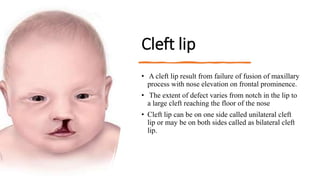 Cleft lip
• A cleft lip result from failure of fusion of maxillary
process with nose elevation on frontal prominence.
• The extent of defect varies from notch in the lip to
a large cleft reaching the floor of the nose
• Cleft lip can be on one side called unilateral cleft
lip or may be on both sides called as bilateral cleft
lip.
 