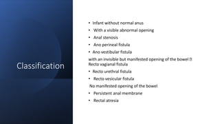 Classification
• Infant without normal anus
• With a visible abnormal opening
• Anal stenosis
• Ano perineal fistula
• Ano vestibular fistula
with an invisible but manifested opening of the bowel
Recto vagianal fistula
• Recto urethral fistula
• Recto vesicular fistula
No manifested opening of the bowel
• Persistent anal membrane
• Rectal atresia
 