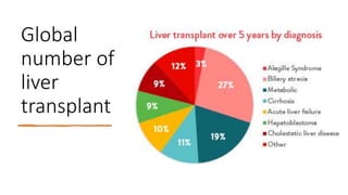 Global
number of
liver
transplant
 