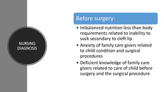 NURSING
DIAGNOSIS
Before surgery:
• Imbalanced nutrition less than body
requirements related to inability to
suck secondary to cleft lip
• Anxiety of family care givers related
to child condition and surgical
procedures
• Deficient knowledge of family care
givers related to care of child before
surgery and the surgical procedure
 