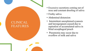 CLINICAL
FEATURES
• Excessive secretions coming out of
nose and constant drooling of saliva
• Frothy saliva
• Abdominal distension
• Intermittent unexplained cyanosis
and laryngospasm caused due to
aspiration of accumulated saliva in
blind oesophageal pouch
• Pneumonia may occur due to
overflow of milk and saliva
 