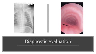 Diagnostic evaluation
 