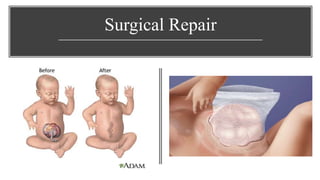 Surgical Repair
 