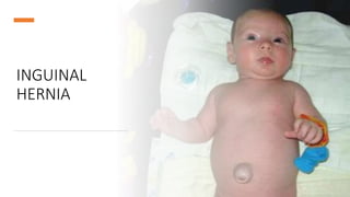 INGUINAL
HERNIA
 