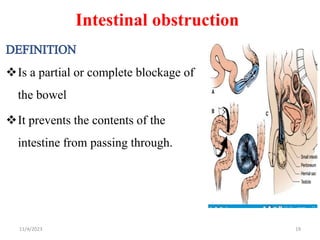 Intestinal obstruction
Is a partial or complete blockage of
the bowel
It prevents the contents of the
intestine from passing through.
11/4/2023 19
 