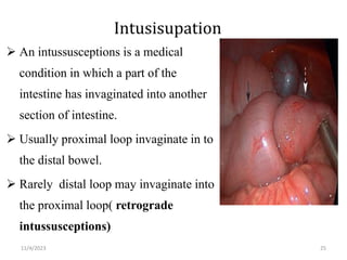 Intusisupation
 An intussusceptions is a medical
condition in which a part of the
intestine has invaginated into another
section of intestine.
 Usually proximal loop invaginate in to
the distal bowel.
 Rarely distal loop may invaginate into
the proximal loop( retrograde
intussusceptions)
25
11/4/2023
 