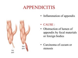 GASTRO INTESTINAL SYSTEM Of HUMAN BODY SYSTEM | PPTX