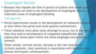Varices Pathogenesis Comprehensive Overview of Gastrointestinal Tract Disorders and ...