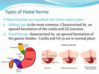 Types of Hiatal hernia
 Hiatal hernias are classified into three major types :
1) sliding type is the most common. Characterized by an
upward herniation of the cardia and GE junction.
2) Fixed hernia characterized by an upward herniation of
the gastric fundus. Cardia and GE jn are in normal place
 