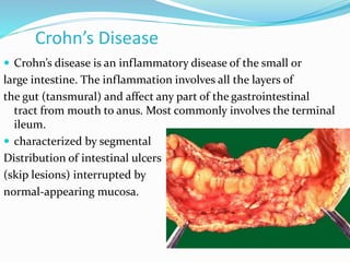 Crohn’s Disease
 Crohn’s disease is an inflammatory disease of the small or
large intestine. The inflammation involves all the layers of
the gut (tansmural) and affect any part of the gastrointestinal
tract from mouth to anus. Most commonly involves the terminal
ileum.
 characterized by segmental
Distribution of intestinal ulcers
(skip lesions) interrupted by
normal-appearing mucosa.
 